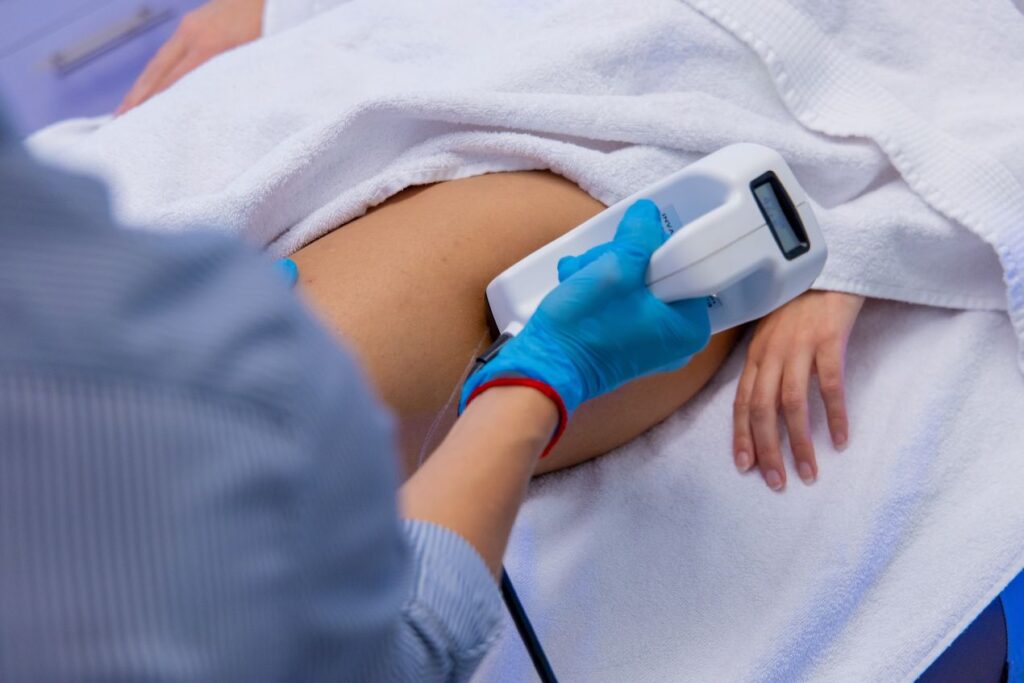 Professionelle Haarentfernung in Duesseldorf mit moderner Lasertechnologie am Bein, durchgeführt von medizinischem Fachpersonal.